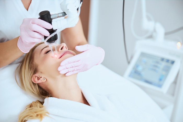 fractional laser