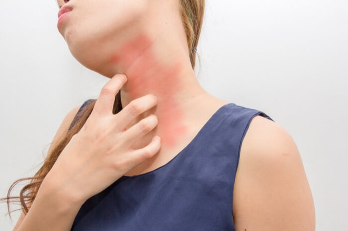 derma